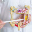 Médico sosteniendo un modelo de colon, representando la detección y prevención del cáncer colorrectal.