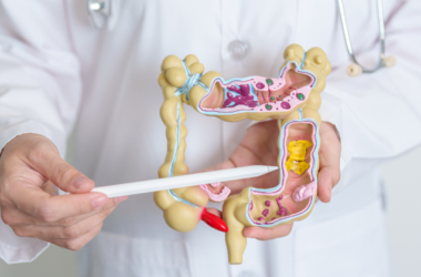 Médico sosteniendo un modelo de colon, representando la detección y prevención del cáncer colorrectal.