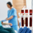 Un profesional de la salud sostiene una bandeja con pruebas de sangre. En el fondo se puede ver a una enfermera preparando a una paciente para sacarle sangre.