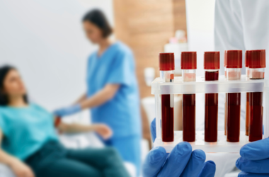 Un profesional de la salud sostiene una bandeja con pruebas de sangre. En el fondo se puede ver a una enfermera preparando a una paciente para sacarle sangre.