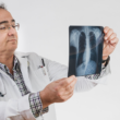 Un doctor observando cuidadosamente radiografías de unos pulmones, haciendo referencia a la salud pulmonar.
