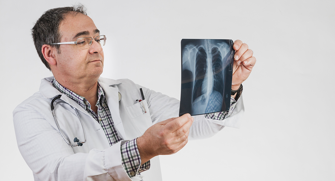 Un doctor observando cuidadosamente radiografías de unos pulmones, haciendo referencia a la salud pulmonar.