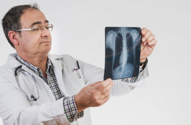 Un doctor observando cuidadosamente radiografías de unos pulmones, haciendo referencia a la salud pulmonar.