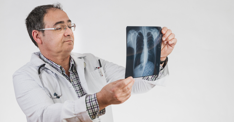 Un doctor observando cuidadosamente radiografías de unos pulmones, haciendo referencia a la salud pulmonar.